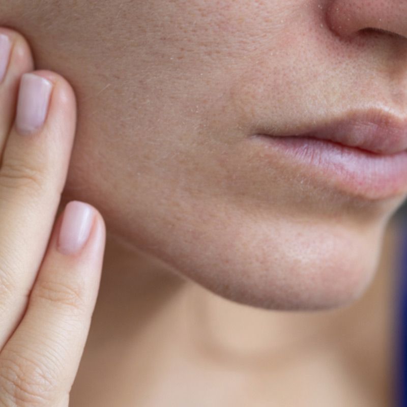 Suva koža lica – Nega i saveti