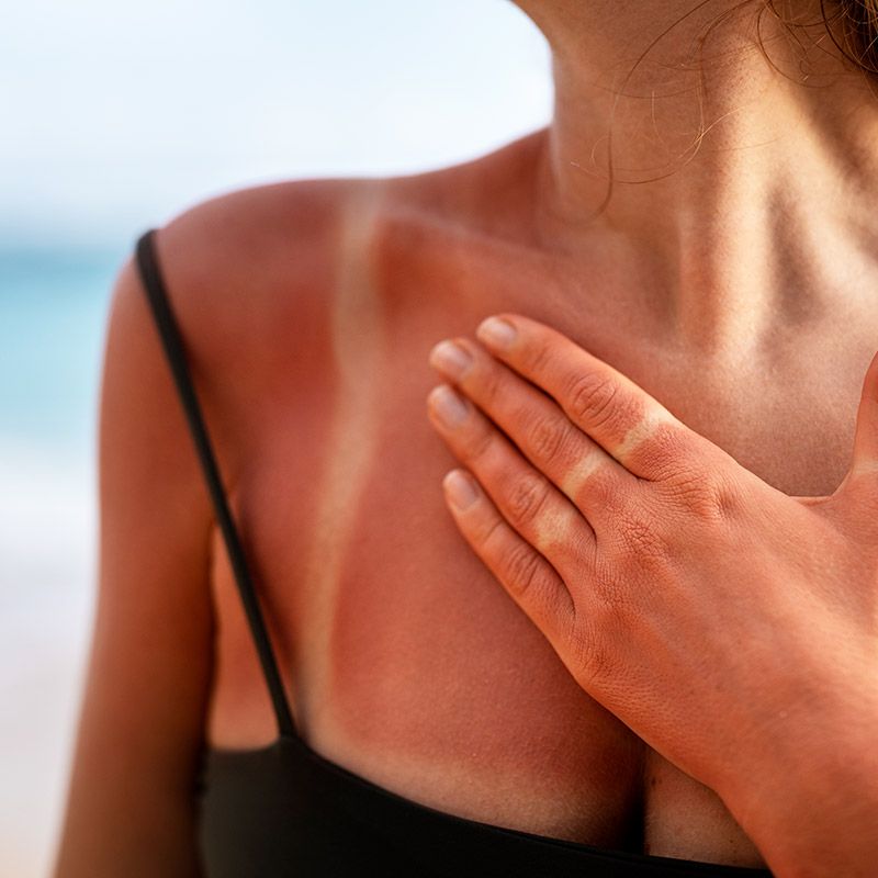 Šta je SPF i zašto je bitan?