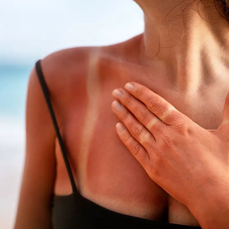 spf zastita od sunca