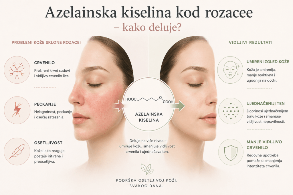 Azelainska kiselina kod rozacee – smanjenje crvenila, peckanja i osetljivosti kože